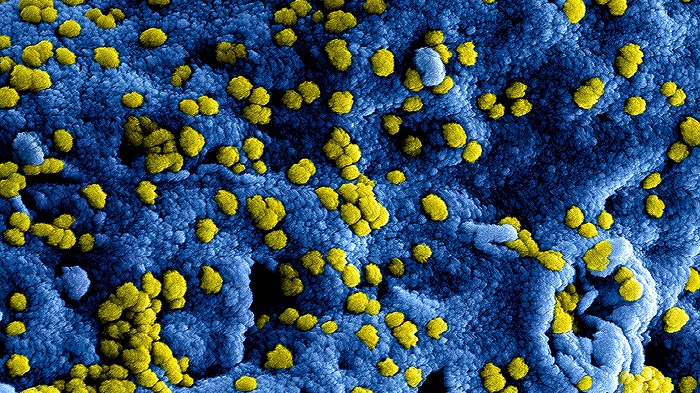 bacteria in tooth infection