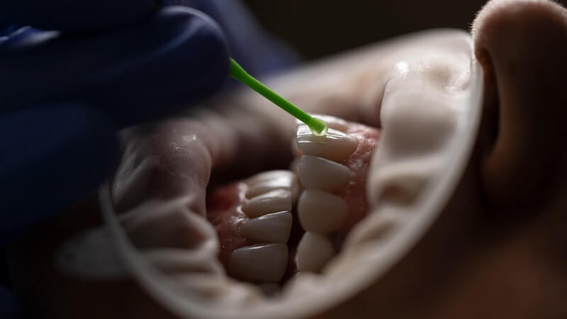 a surgery after tooth infetcion
